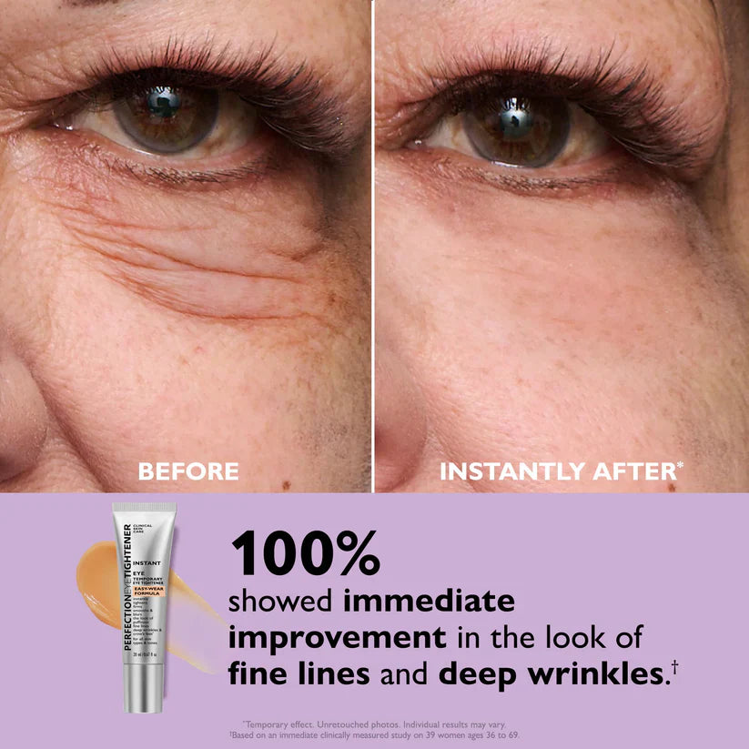 Best seller🔥60%OFF Instant Eye Tightener Easy-Wear Formula With Brush Free!